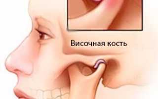Что нужно знать о причинах, симптомах и методах лечения артрита челюстного сустава