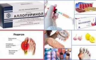 Лечение подагры препаратами, выводящими мочевую кислоту
