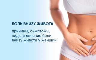 Причины, симптомы и лечение болей в нижней части живота у женщин