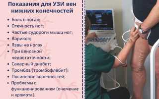 УЗДГ сосудов нижних конечностей