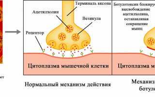 Что следует знать о воздействии ботокса на процесс грудного вскармливания – изучение фактов и разбор мифов
