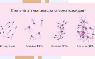 Мар-тест: что это и как понять его результаты и значения