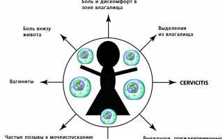 Проявления и методы борьбы с уреаплазмозом у постоянных невиновных девушек