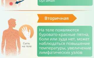 Методы анонимного анализа на сифилис – обнаружение и лечение заболевания