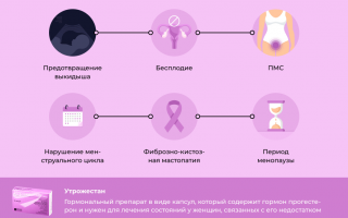 Преимущества и побочные эффекты применения Утрожестана на 29 неделе беременности