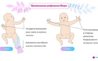 Рефлекс Моро: его сущность, проявление и причины необходимости