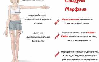 Марфан Синдром: клинические особенности, методы лечения и наблюдения. Советы и рекомендации от Медицинского портала.