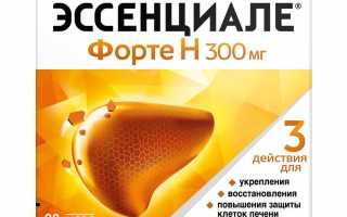 Применение и преимущества использования препарата “Эссенциале” при лечении псориаза