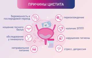 Как облегчить симптомы и улучшить самочувствие при приступе цистита