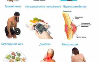 Спинальный миозит: причины, симптомы, методы лечения