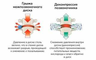 Способы лечения и особенности проведения декомпрессии позвоночного канала