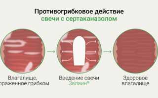 Как выбрать и правильно использовать свечи перед родами