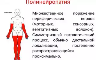 Полинейропатия: причины, симптомы, методы диагностики и эффективное лечение