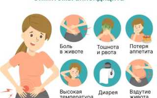 Признаки аппендицита у женщин