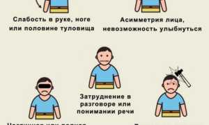 Как проявляется инсульт: не пропустите самые первые признаки