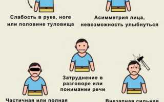 Как проявляется инсульт: не пропустите самые первые признаки