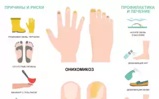 Признаки и характеристики грибка на ногах: как определить наличие, симптомы и методы лечения.