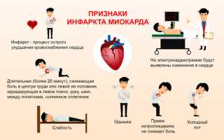 Что такое инфаркт сердца и как его предотвратить