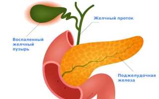 Изучаем признаки, причины и методы лечения увеличенного желчного пузыря
