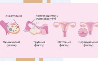 Как смазка может влиять на шансы забеременеть – рассмотрим мифы и факты