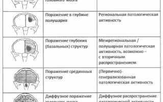 Причины и последствия диффузных изменений биоэлектрической активности головного мозга