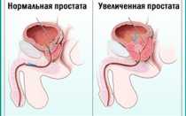 Фурадонин: инструкция, отзывы врачей и пациентов о препарате для мужчин и детей