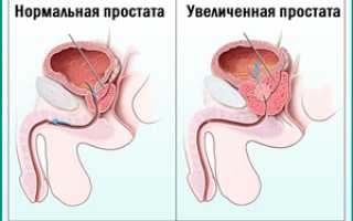 Фурадонин: инструкция, отзывы врачей и пациентов о препарате для мужчин и детей