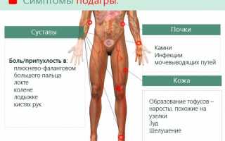 Сущность острой подагры: факторы развития, основные симптомы и методы лечения
