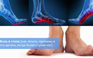 Боль в стопе – сигнал к действию