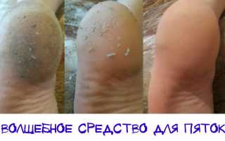 Смягчаем кожу на пятках