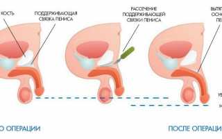 Методы и советы по увеличению размера полового органа – все, что нужно знать