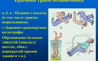 Воздействие перелома позвоночника: особенности, проявления и методы лечения.