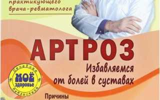 Эффективное лечение артроза суставов с помощью методики доктора Евдокименко: новые подходы к борьбе с проблемами суставов.
