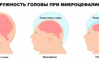 Микроцефалия взрослых женщин: причины, симптомы и особенности заболевания