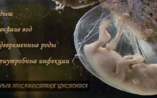 Цистит на ранних сроках беременности: причины, симптомы, лечение, опасен ли он