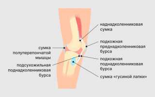 Как распознать и излечить бурсит коленного сустава?