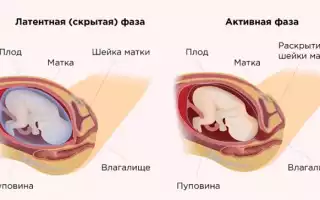 Раскрытие матки при родах: все, что важно знать