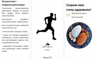 Советы и рекомендации по эффективному лечению плоскостопия у подростков