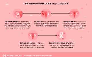 Тянет внизу живота после овуляции: возможные причины и способы снятия дискомфорта