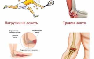 Болевые ощущения на локте: причины, симптомы и методы лечения