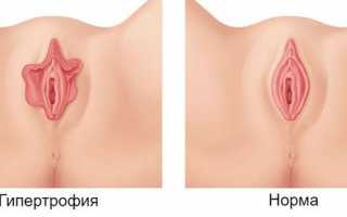 Основные причины и способы решения проблемы потемнения половых губ.