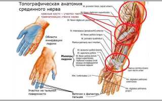 Нейропатия срединного нерва: причины, симптомы и методы лечения