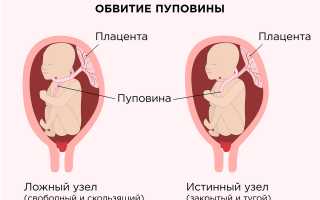 Судьба пуповины после родов: куда она исчезает у молодых мам? Основные факты, которые стоит знать.
