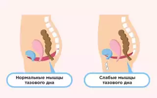 Изменение состояния влагалища после родов: восстановление и уход.