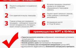 Подробная инструкция по проведению МРТ коленного сустава: шаг за шагом