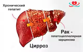 Влияние алкоголя на организм при одновременном приеме амлодипина: что следует учитывать