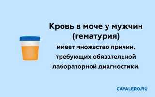 Почему моча с кровью у мужчин: причины, диагностика, лечение гематурии