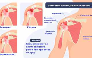 Почему возникают боли в левом плече и подмышке? Основные причины и методы диагностики