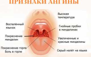 Причины, симптомы и лечение аллергического отека гортани: что нужно знать и что делать