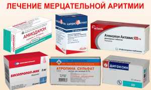 Чем лечить аритмию сердца: лучшие средства